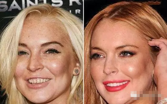 廣州國(guó)際美博會(huì),相約薇絲頓牙齒美白納米齒雕(圖6) 廣州國(guó)際美博會(huì),相約薇絲頓牙齒美白納米齒雕(圖6)